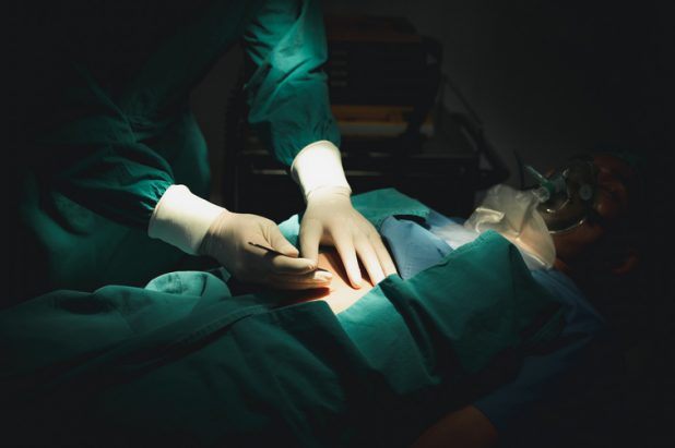 doctors works together to monitor patients. Surgery on patients lying on patient beds. resuscitation sala imbalsamare decedat firma specializata